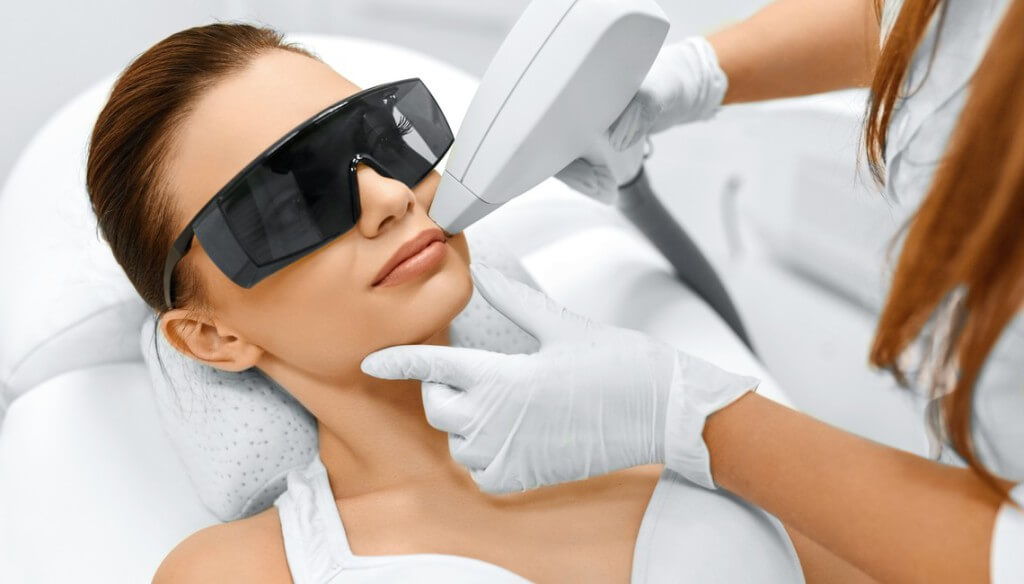 Una donna che si sottopone ad una seduta di depilazione laser baffetto.