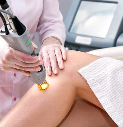 Una ragazza che si sta sottoponendo ad una seduta di depilazione laser alle gambe.
