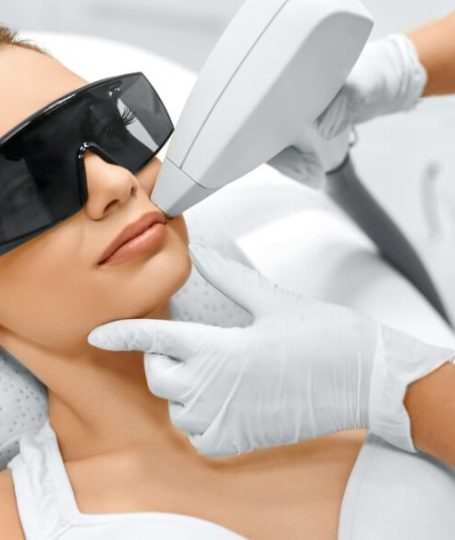 Una donna che si sottopone ad una seduta di depilazione laser baffetto.